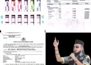 Kades Kerta Bantah Tuduhan Narkoba dengan Hasil Tes Urin Negatif, Soroti Pembangkangan BPD dan Prades