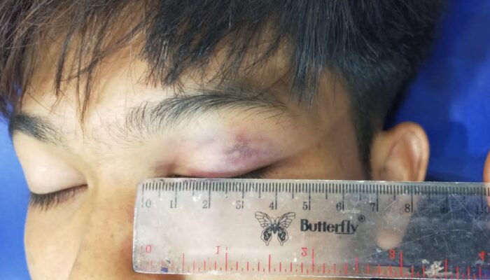 Oknum Kades Tegal Wangi Dilaporkan ke Polisi Atas Dugaan Penganiayaan Anak di Bawah Umur
